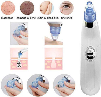 Derma Suction Blackhead Remover – Electric Pore Cleaner & Deep Facial Cleansing Device