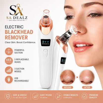 5-in-1 Blackhead Remover – Deep Pore Facial Cleansing & Skin Care Tool