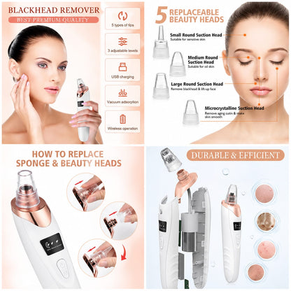 5-in-1 Blackhead Remover – Deep Pore Facial Cleansing & Skin Care Tool